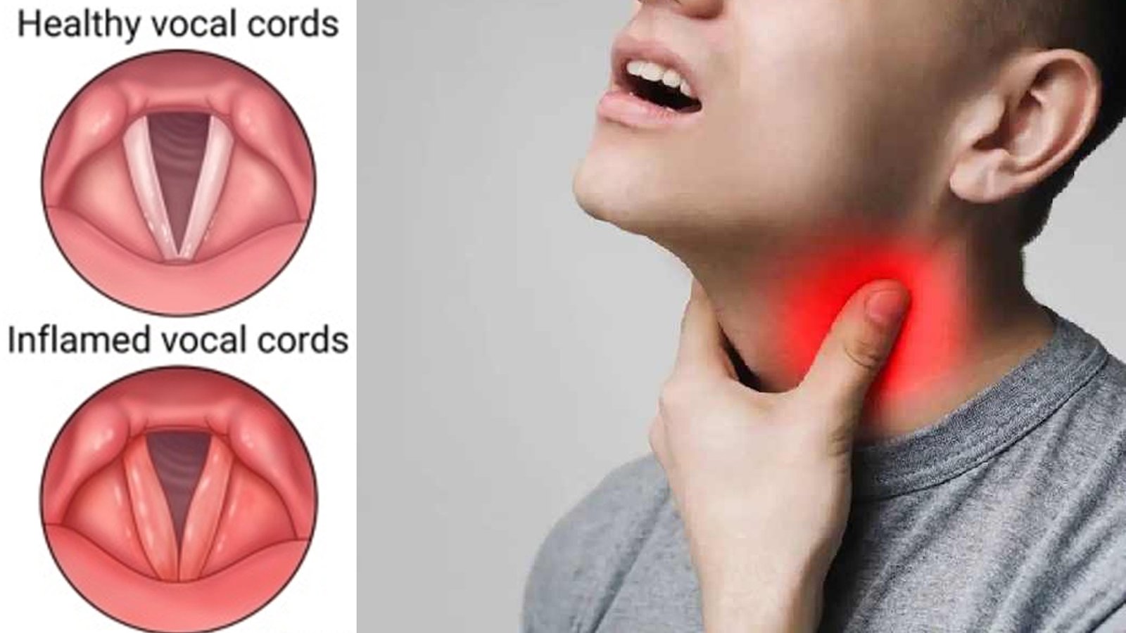 গলার স্বর বসে গেলে করণীয়
