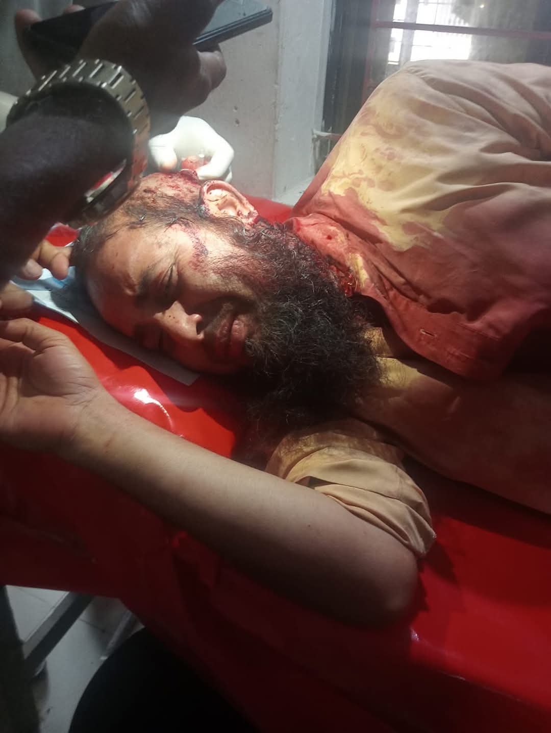 রাঙামাটির লংগদুতে মাদ্রাসার সীমানা নিয়ে বিরোধ: প্রতিপক্ষের দায়ের কোপে প্রধান শিক্ষক গুরুতর আহত