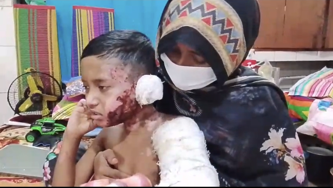 মাগুরায় সাত বছরের শিশুকে পেট্রোল ঢেলে আগুনে পুড়িয়ে হত্যাচেষ্টার অভিযোগ