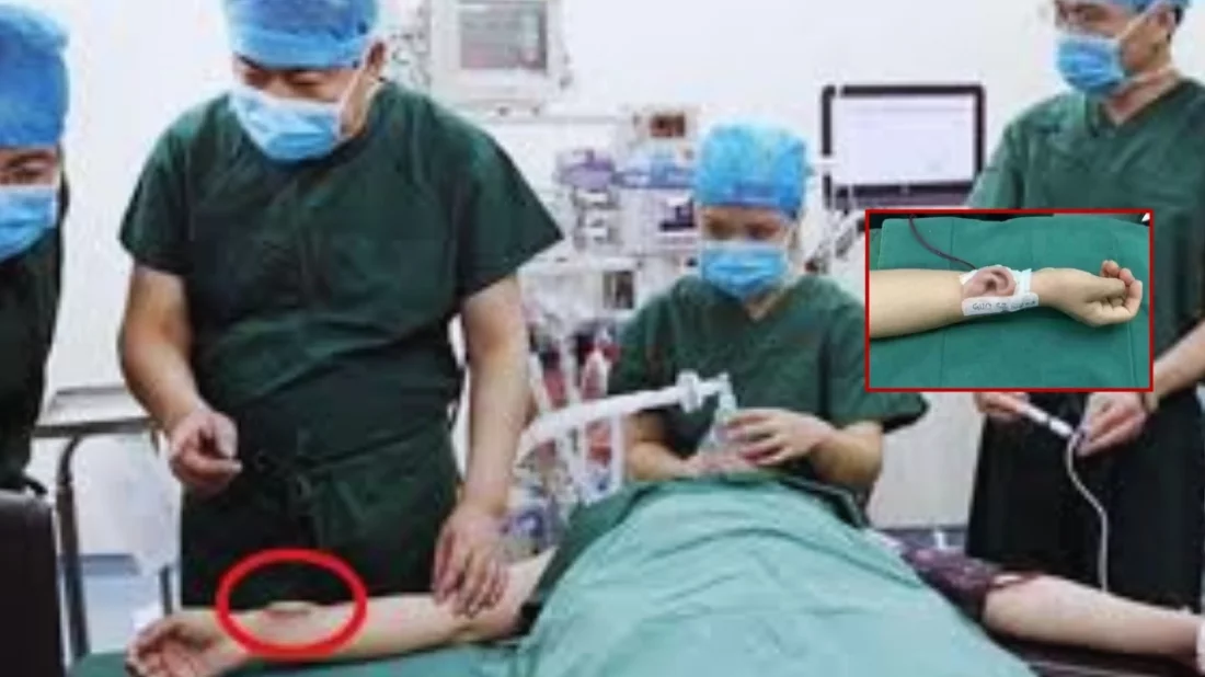 কাটা কান পায়ে বাঁচিয়ে রেখে পুনরায় মাথায় প্রতিস্থাপন