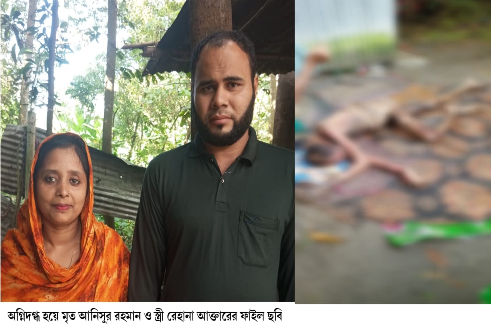 শিকলবন্দি অবস্থায় দগ্ধ হয়ে প্রতিবন্ধী যুবকের মৃত্যু, স্ত্রীর অভিযোগ অবহেলাজনিত হত্যা।